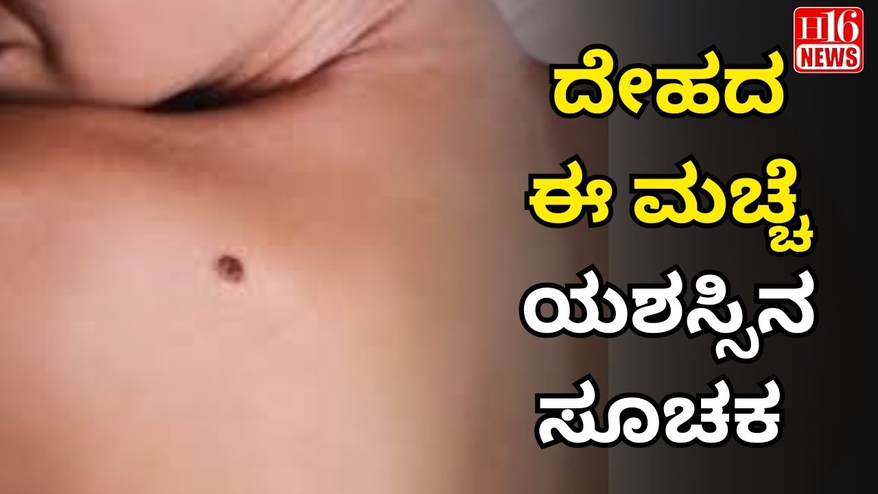 ದೇಹದ ಈ ಮಚ್ಚೆ ಯಶಸ್ಸಿನ ಸೂಚಕ