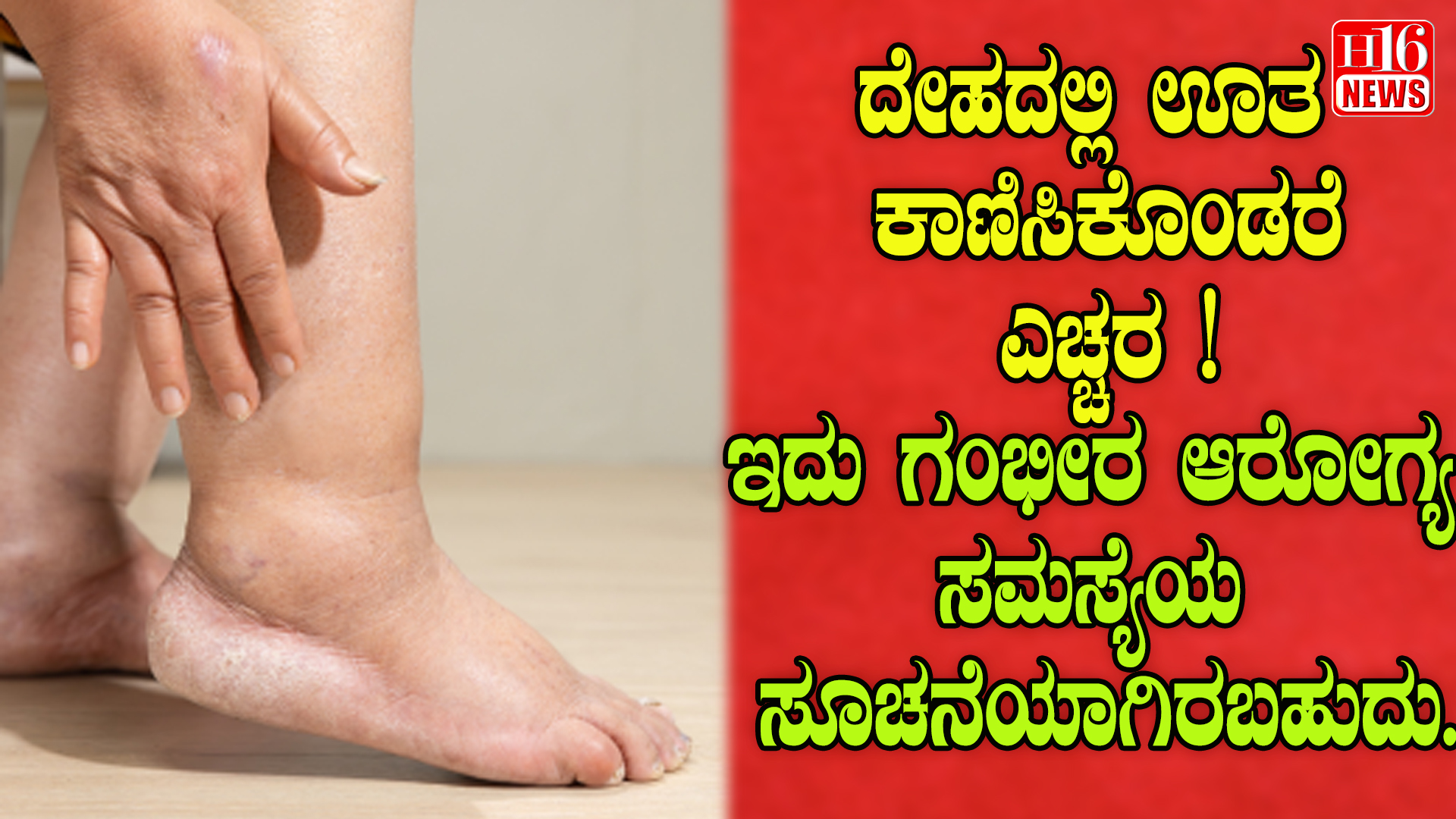 ದೇಹದಲ್ಲಿ ಊತ ಕಾಣಿಸಿಕೊಂಡರೆ ಎಚ್ಚರ ! ಇದು ಗಂಭೀರ ಆರೋಗ್ಯ ಸಮಸ್ಯೆಯ ಸೂಚನೆಯಾಗಿರಬಹುದು.
